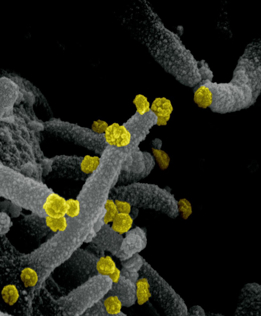SARS-CoV-2 (round yellow particles) emerging from the surface of a cell cultured in the lab.